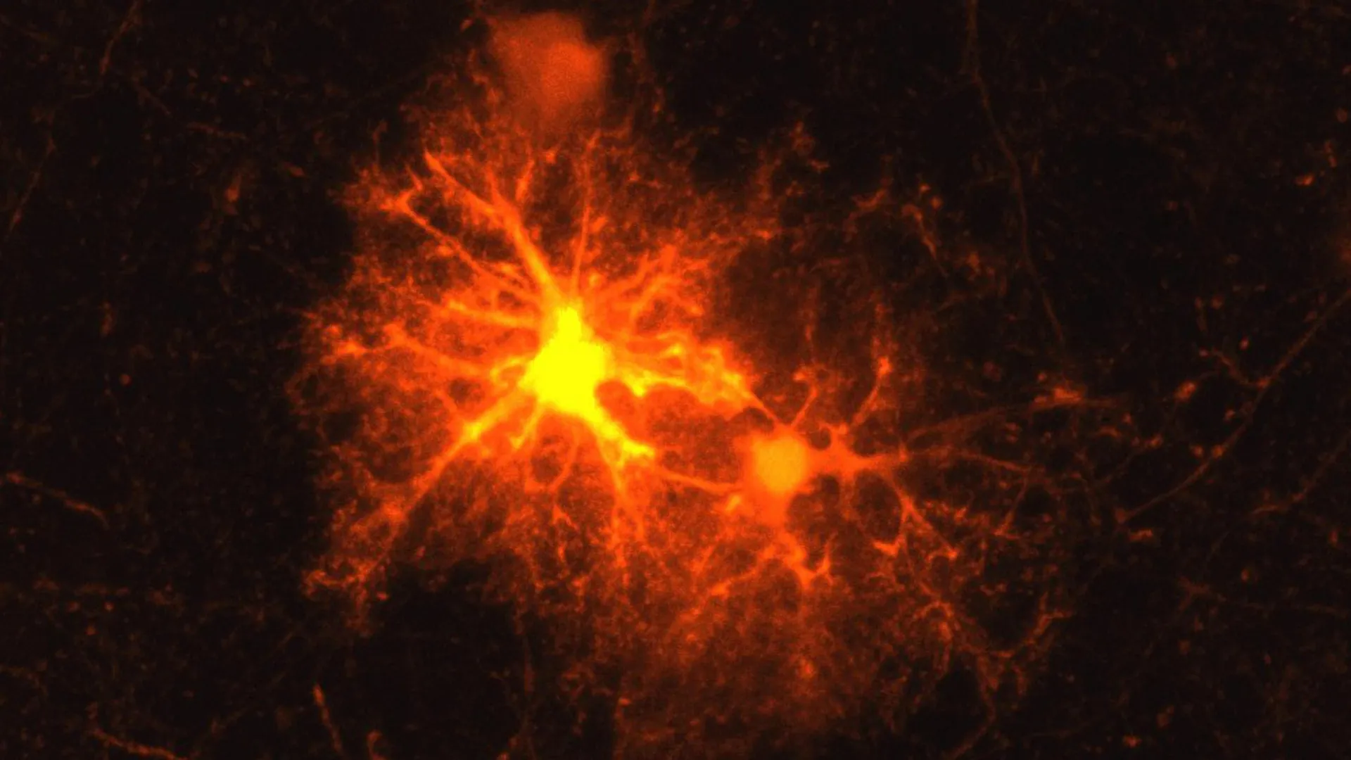 压力激素:大脑的自我修复师